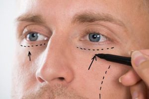 There is a Growing Popularity in Cosmetic Surgeries for Men