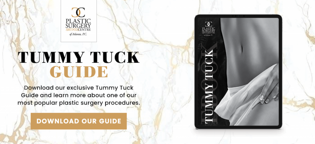 Tummy Tuck Guide