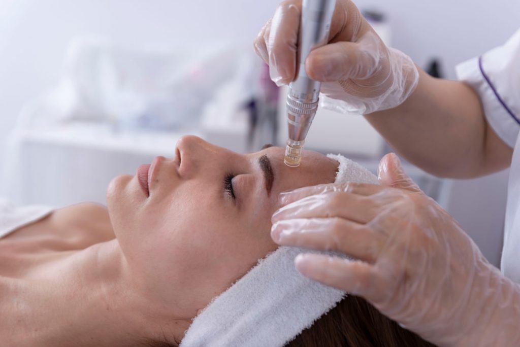 How Often Should You Do Microneedling?