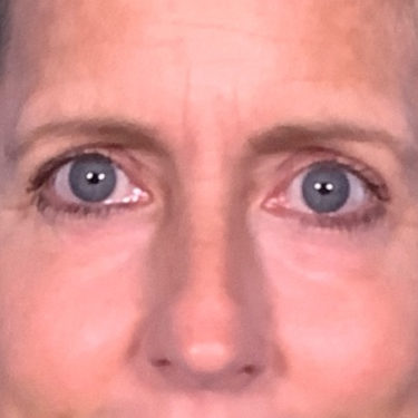 After Image