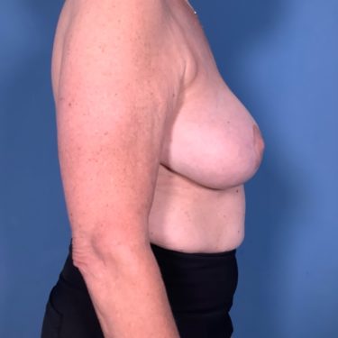 After Image
