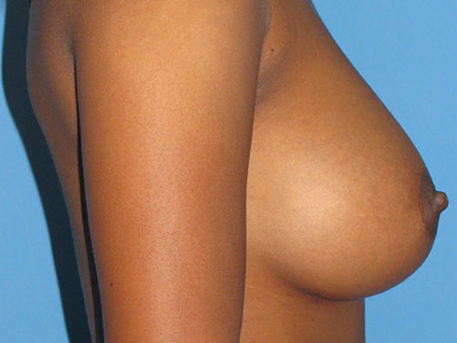 After Image
