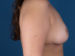 After Image