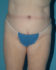 After Image