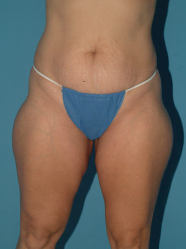 Before Image
